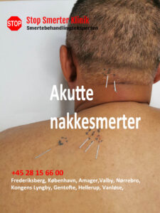 Akutte nakkesmerter i Frederiksberg