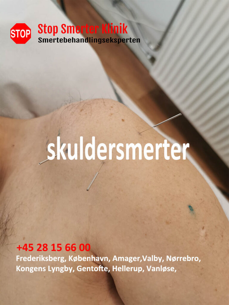 skuldersmerter i Frederiksberg