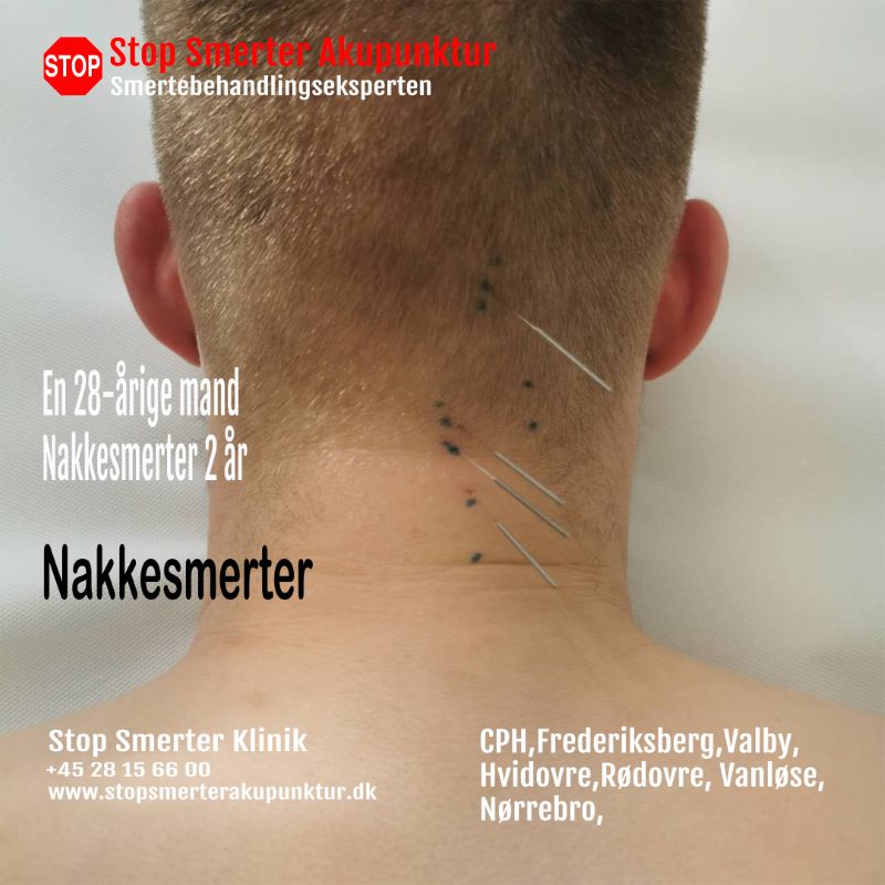 Nakkesmerter